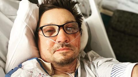 Una foto publicada en la cuenta de Instagram de Renner muestra al actor en lo que parece ser una cama de hospital con heridas en la cara.